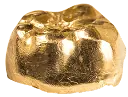 Zahngold – Goldankauf
